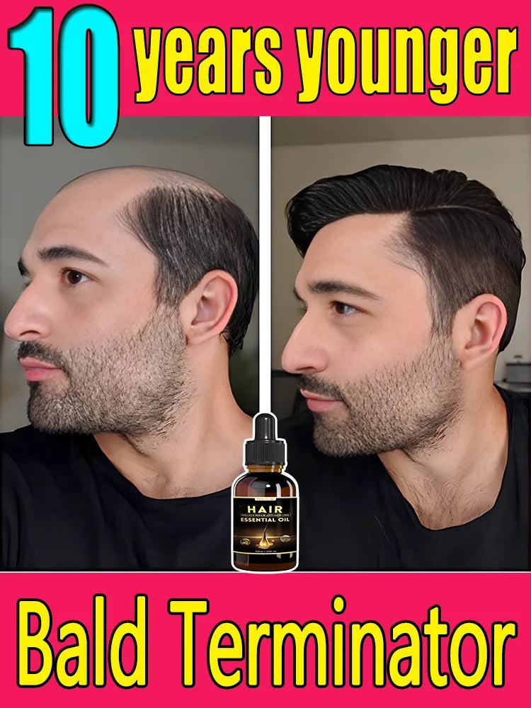 Best-selling Hair Growth Products, Anti-Hair Loss Hair Growth Serum for Men and Women, Fast Hair Growth Oil, 100% Natural
