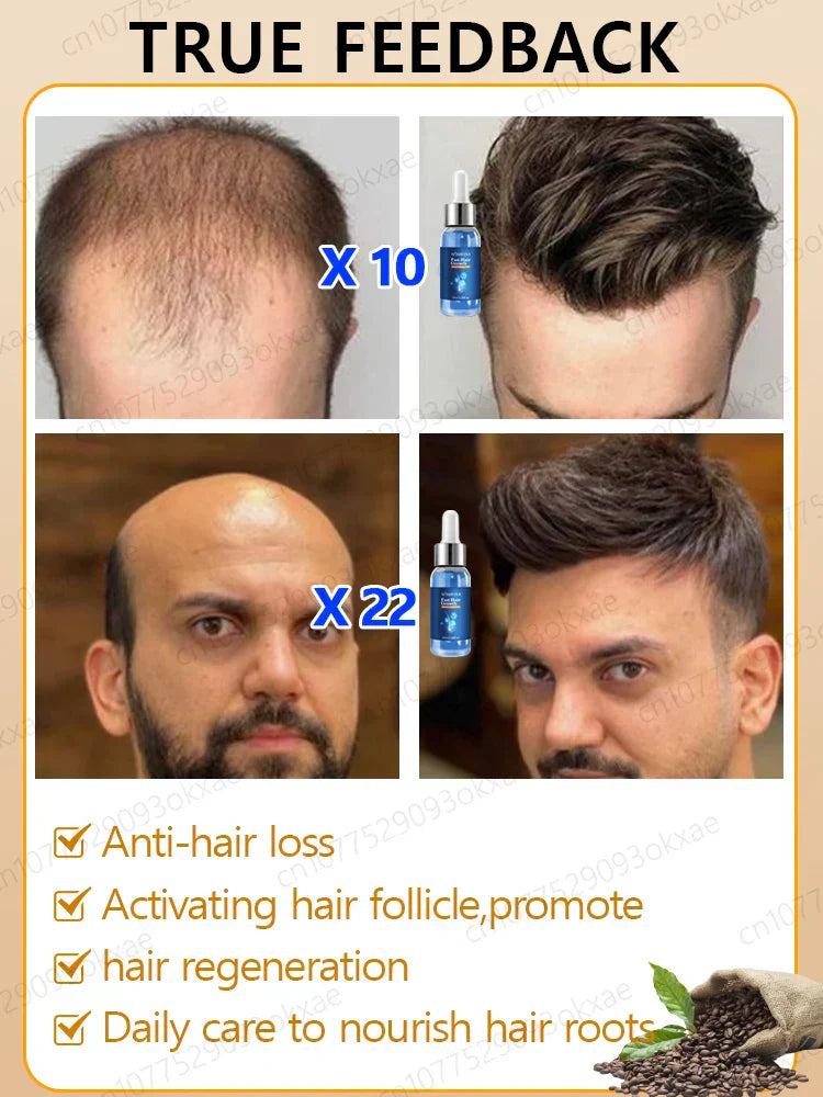 Fast Hair Growth Essence Oil Products Effective Baldness Repair Treatment Anti Hereditary Seborrheic Alopecia Loss For Men Women