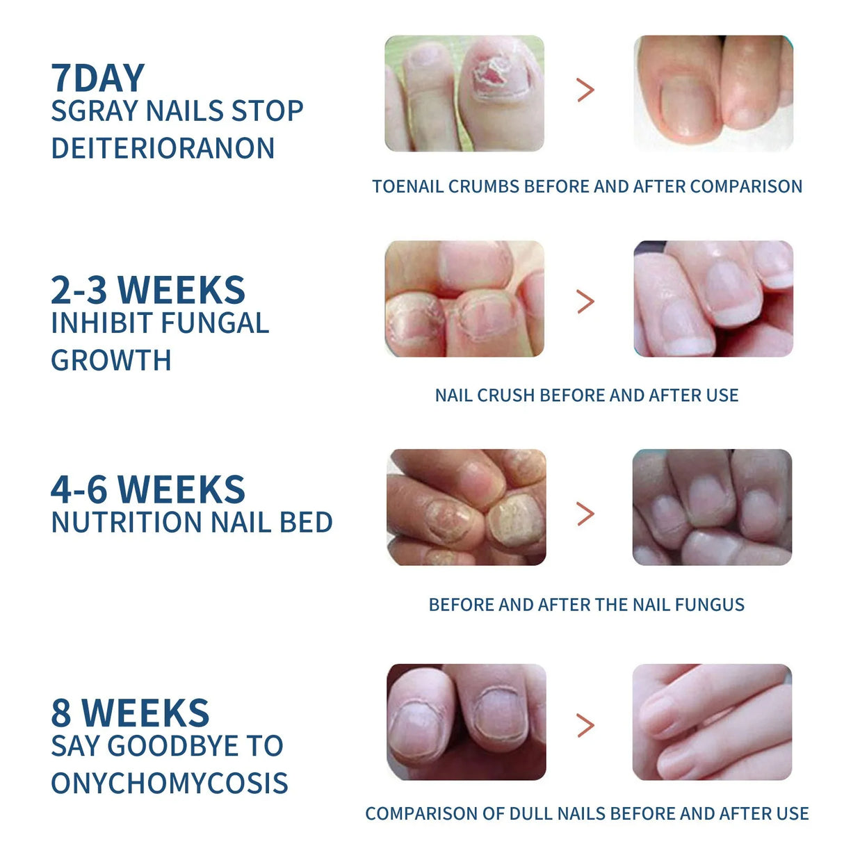 (Pack of 64) 32/ Paronychia Treatment Patch Fungus Removal Nail Ingrown Correction Stickers Nails Recover Pedicure Tools Health Care