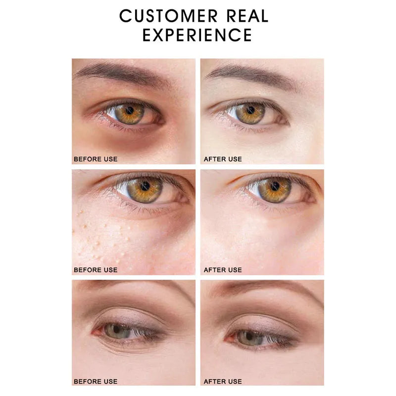 (Pack of 120) ARTISCARE Seaweed/Black Pearl Collagen Eye Patches Remove Dark Circle Anti wrinkle Sleep Eye Mask Moisturizing Eye Care
