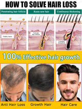Hair growth products Fast Hair Growth Hair Growth Oil Effective Baldness Repair Hereditary Hair Loss Seborrheic Hair Anti Loss