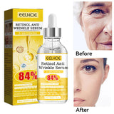 Retinol Anti Wrinkle Essence Reduces Fine Lines Lifts Tightens Skin Improves Dullness Removes Facial Wrinkles Moisturizes Care