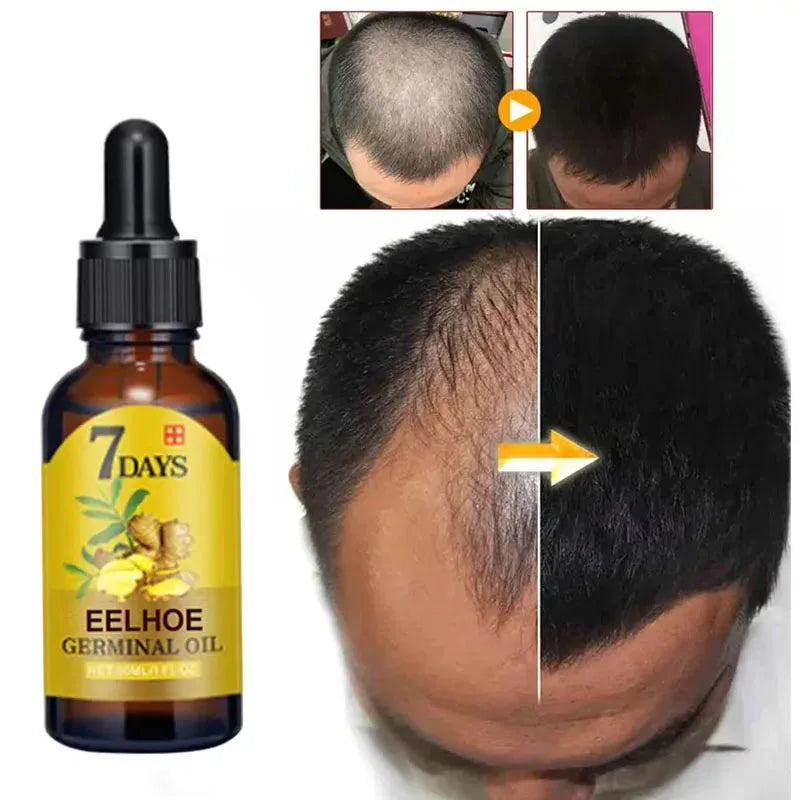7 Days Fast Ginger Hair Growth Serum Anti-loss Hair Regrowth Essential Oil Repair Damaged Hair Roots Hair Care For Women Men