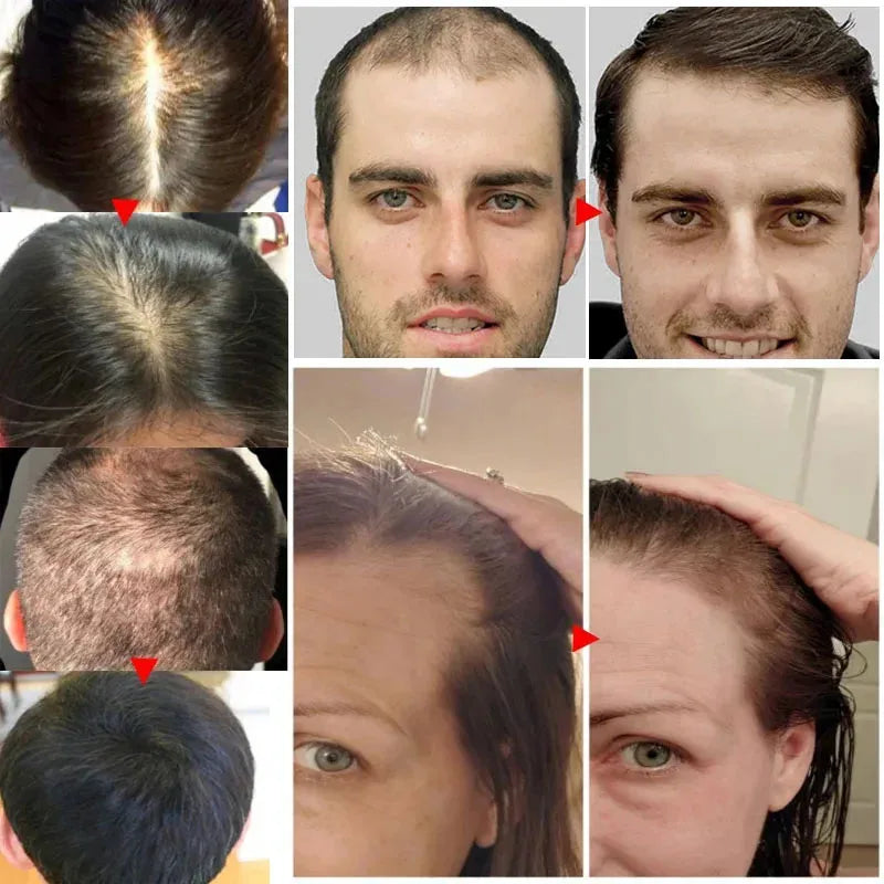 7 Days Fast Ginger Hair Growth Serum Anti-loss Hair Regrowth Essential Oil Repair Damaged Hair Roots Hair Care For Women Men